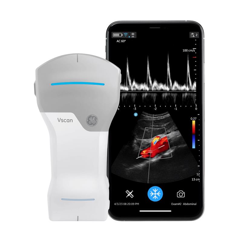 Vscan Air™ CL